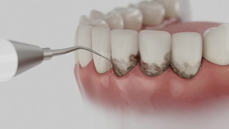 Reliable Dental Implants contractor in Weaverville, CA by Smile Center Dentistry